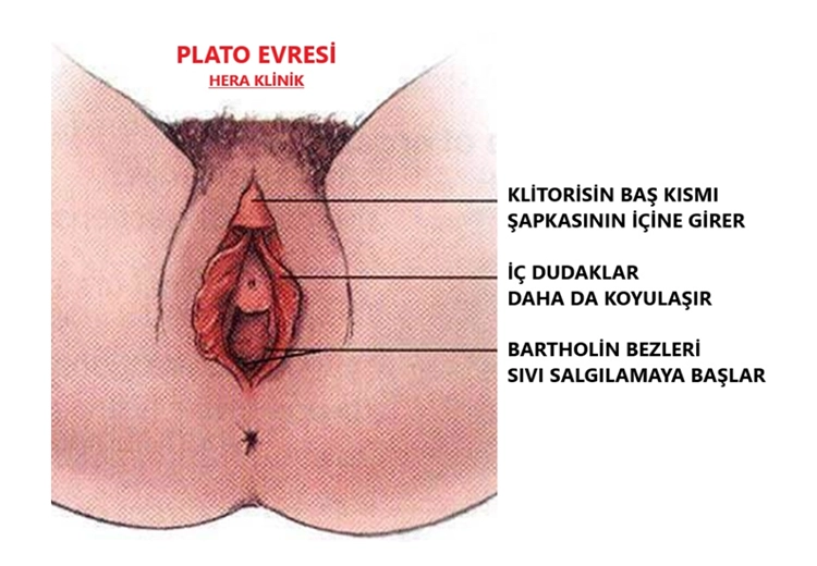 Plato Evresi